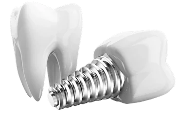 протезирование зубов в сургуте виды и цены