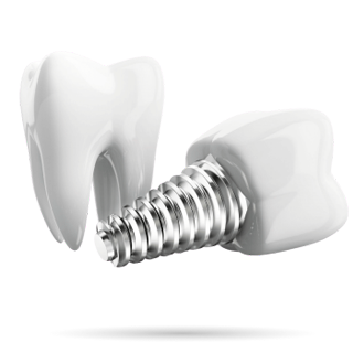 протезирование зубов